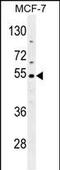 Cocaine esterase antibody, A02868-1, Boster Biological Technology, Western Blot image 