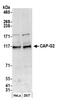 Non-SMC Condensin II Complex Subunit G2 antibody, NB100-1813, Novus Biologicals, Western Blot image 