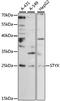 Serine/Threonine/Tyrosine Interacting Protein antibody, 15-989, ProSci, Western Blot image 