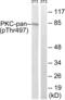 PKC antibody, LS-C199461, Lifespan Biosciences, Western Blot image 