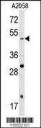 SRY-Box 4 antibody, TA324704, Origene, Western Blot image 