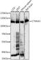Catenin Alpha 3 antibody, A05039, Boster Biological Technology, Western Blot image 