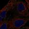 DENN Domain Containing 3 antibody, HPA024491, Atlas Antibodies, Immunocytochemistry image 