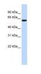 SH3 Domain Binding Protein 2 antibody, NBP1-58872, Novus Biologicals, Western Blot image 