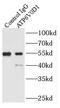 ATPase H+ Transporting V0 Subunit D1 antibody, FNab00714, FineTest, Immunoprecipitation image 