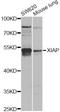 X-Linked Inhibitor Of Apoptosis antibody, LS-C748335, Lifespan Biosciences, Western Blot image 