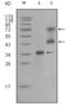 Ret Proto-Oncogene antibody, abx016052, Abbexa, Enzyme Linked Immunosorbent Assay image 