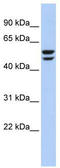 ATPase H+ Transporting V1 Subunit B2 antibody, TA337650, Origene, Western Blot image 