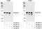 Kinesin-like protein KIF2C antibody, A300-806A, Bethyl Labs, Immunoprecipitation image 