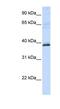 Hydroxyacid Oxidase 2 antibody, NBP1-53164, Novus Biologicals, Western Blot image 