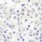 SMG8 Nonsense Mediated MRNA Decay Factor antibody, NB100-74598, Novus Biologicals, Immunohistochemistry paraffin image 