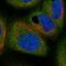 WAP Four-Disulfide Core Domain 2 antibody, HPA042302, Atlas Antibodies, Immunocytochemistry image 