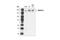 Platelet Derived Growth Factor Receptor Beta antibody, 3169T, Cell Signaling Technology, Western Blot image 