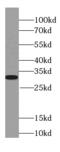 Non-Homologous End Joining Factor 1 antibody, FNab09545, FineTest, Western Blot image 