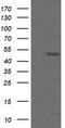 TAP Binding Protein Like antibody, TA505552, Origene, Western Blot image 