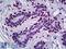 Tumor Protein P63 antibody, LS-B5252, Lifespan Biosciences, Immunohistochemistry paraffin image 
