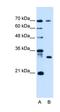 ATPase H+ Transporting Accessory Protein 1 Like antibody, orb325183, Biorbyt, Western Blot image 