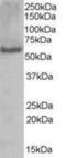 Poly(U) Binding Splicing Factor 60 antibody, NB100-1125, Novus Biologicals, Western Blot image 