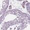 Transmembrane Protein 121B antibody, HPA068790, Atlas Antibodies, Immunohistochemistry paraffin image 