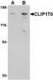 CAP-Gly domain-containing linker protein 1 antibody, TA306599, Origene, Western Blot image 