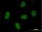 Chromosome 9 Open Reading Frame 152 antibody, H00401546-B01P, Novus Biologicals, Immunofluorescence image 