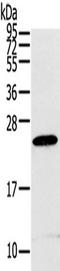 Regulator Of G Protein Signaling 1 antibody, TA350346, Origene, Western Blot image 