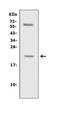 Macaca mulatta Interleukin-10 antibody, RP1016, Boster Biological Technology, Enzyme Linked Immunosorbent Assay image 