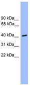 Casein Kinase 1 Alpha 1 Like antibody, TA340392, Origene, Western Blot image 
