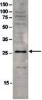 Sin3A Associated Protein 30 antibody, PA5-40068, Invitrogen Antibodies, Western Blot image 