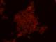 ERBB2 antibody, 10004-R511-P, Sino Biological, Immunofluorescence image 