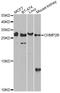 Charged Multivesicular Body Protein 2B antibody, A13410, ABclonal Technology, Western Blot image 