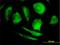 Phytanoyl-CoA dioxygenase, peroxisomal antibody, H00005264-B01P, Novus Biologicals, Immunocytochemistry image 
