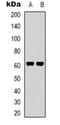 SV2 Related Protein antibody, orb319044, Biorbyt, Western Blot image 