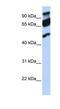 Era Like 12S Mitochondrial RRNA Chaperone 1 antibody, NBP1-57493, Novus Biologicals, Western Blot image 