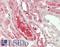 Pleckstrin Homology Domain Containing J1 antibody, LS-B13603, Lifespan Biosciences, Immunohistochemistry paraffin image 