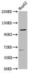 Leucine-rich repeats and immunoglobulin-like domains protein 2 antibody, LS-C680790, Lifespan Biosciences, Western Blot image 