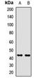 Inositol Polyphosphate-1-Phosphatase antibody, LS-C667862, Lifespan Biosciences, Western Blot image 