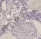 CD209 Molecule antibody, PA5-78968, Invitrogen Antibodies, Immunohistochemistry frozen image 