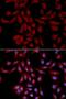 p18 antibody, LS-B14878, Lifespan Biosciences, Immunofluorescence image 