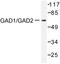 Glutamate Decarboxylase 2 antibody, LS-C176279, Lifespan Biosciences, Western Blot image 