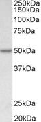 Programmed Cell Death 4 antibody, STJ72822, St John