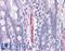 EGF-containing fibulin-like extracellular matrix protein 1 antibody, LS-B4607, Lifespan Biosciences, Immunohistochemistry paraffin image 