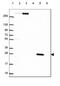 Quinoid Dihydropteridine Reductase antibody, HPA065649, Atlas Antibodies, Western Blot image 