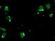 Signal Sequence Receptor Subunit 1 antibody, TA503267, Origene, Immunofluorescence image 