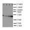 GLI Family Zinc Finger 3 antibody, orb76279, Biorbyt, Western Blot image 