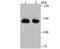 Splicing Factor 3b Subunit 1 antibody, A00507-1, Boster Biological Technology, Western Blot image 