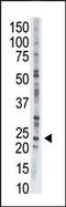 Adenylate Kinase 1 antibody, PA5-15485, Invitrogen Antibodies, Western Blot image 