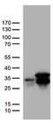 O-6-Methylguanine-DNA Methyltransferase antibody, UM800006, Origene, Western Blot image 