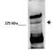 Exophilin 5 antibody, GTX47026, GeneTex, Western Blot image 