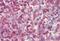 Neutrophil Cytosolic Factor 4 antibody, MBS242524, MyBioSource, Immunohistochemistry paraffin image 
